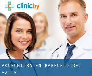 Acupuntura en Barruelo del Valle