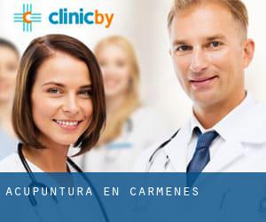 Acupuntura en Cármenes