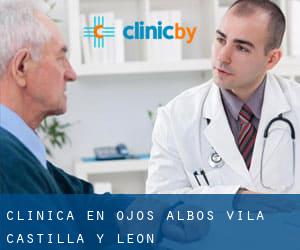 clínica en Ojos-Albos (Ávila, Castilla y León) clínica en Ojos-Albos (Ávila, Castilla y León)